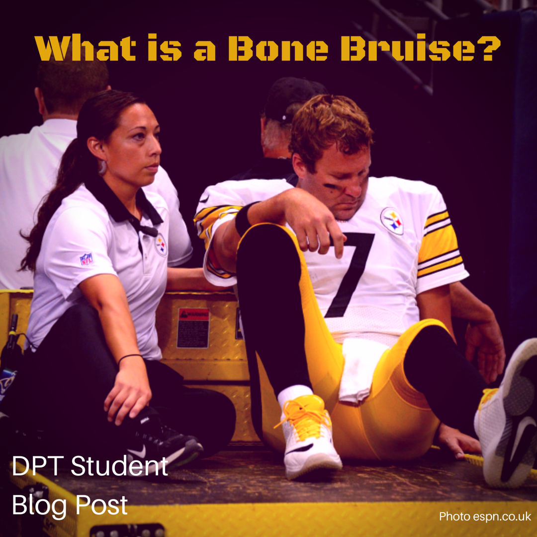 What is a Bone Bruise?